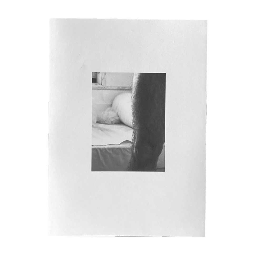Photograph of hairy thigh